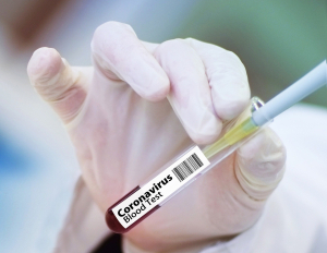 로버트 레드필드 미 CDC 국장 ‘초기 백신 보다 마스크가 효과적’